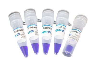 Laboratorio di elettroforesi forense: condannato ingiustamente?