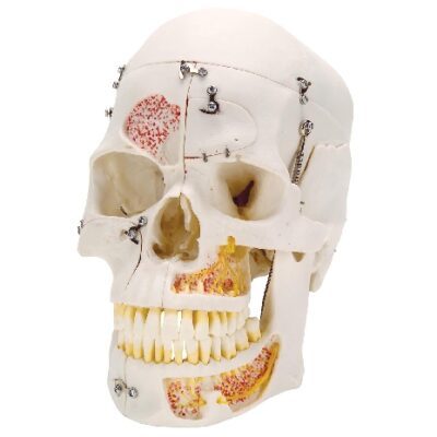 Modello deluxe di cranio dentale per dimostrazione umana, in 10 parti