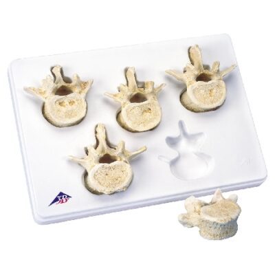 Set di 5 vertebre lombari