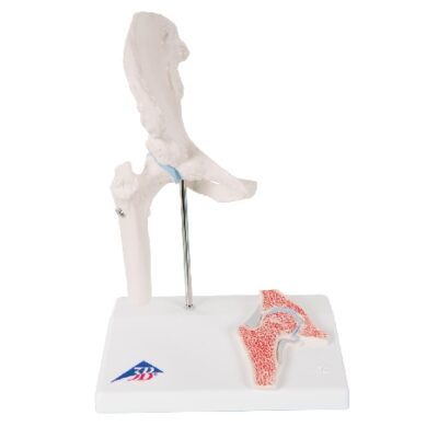 Mini articolazione dell’anca con sezione trasversale