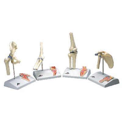 Mini articolazione della spalla con sezione trasversale