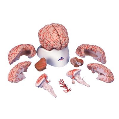 Cervello con arterie, 9 parti
