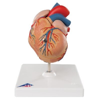 Cuore classico con ipertrofia ventricolare sinistra (LVH), 2 parti