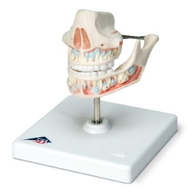 Dentiera al latte