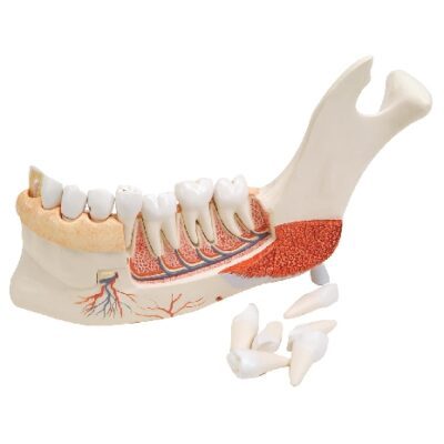 Mezza mascella inferiore avanzata con 8 denti malati, 19 parti