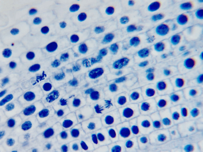 PHYWE Microvetrini preparati Mitosi in scatola di conservazione, 10 vetrini identici