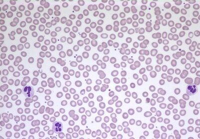 PHYWE Microvetrini preparati Sangue umano in scatola di conservazione, 10 vetrini identici