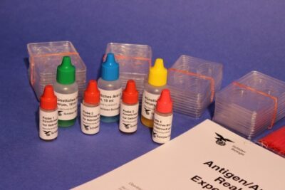 Kit antigene-anticorpo