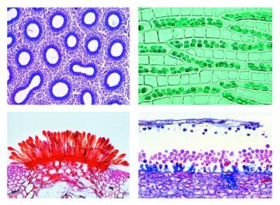 Cryptogamae, set supplementare I, 25 vetrini per microscopio
