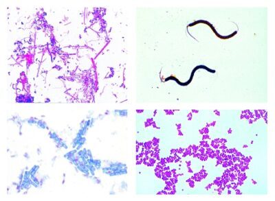 Batteri, 25 vetrini per microscopio