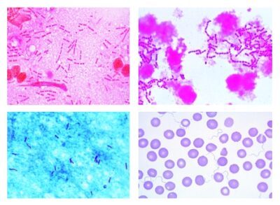 Batteri patogeni, 25 vetrini per microscopio