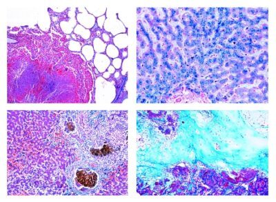 Patologia umana, set medio, parte I, 40 vetrini microscopici (nuova versione)