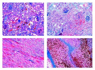 Patologia umana, set medio parte II, 40 vetrini microscopici (nuova versione)
