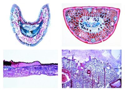 Il legno. Conseguenze dell’inquinamento, 20 vetrini per microscopio