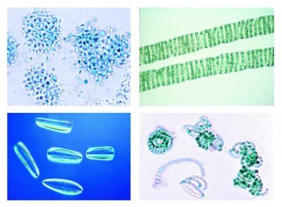 L’inquinamento dell’acqua. Problemi e risultati, 20 vetrini microscopici