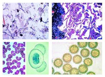 Inquinamento atmosferico e allergeni, 15 vetrini microscopici