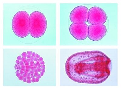 L’embriologia del riccio di mare (Echinus miliaris), 12 vetrini microscopici