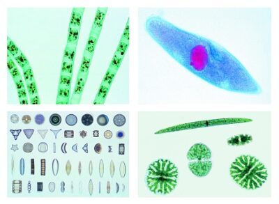 La vita microscopica nell’acqua, parte I, 25 vetrini microscopici