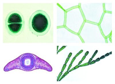 La vita microscopica nell’acqua, parte II, 25 vetrini microscopici
