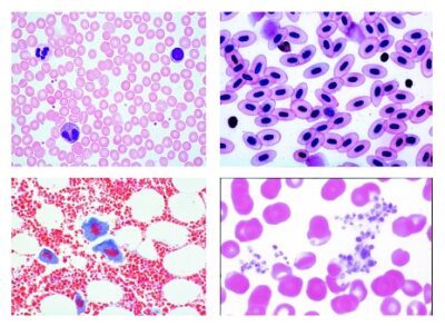 Istologia: sangue, 10 vetrini microscopici