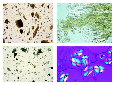 Polveri di farmaci, 25 vetrini per microscopio
