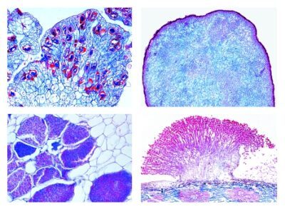 Agricoltura (Funghi parassiti), 20 vetrini per microscopio