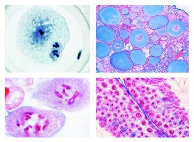Set di vetrini genetici, 25 vetrini per microscopio