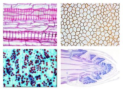 Angiosperme, set di dettagli, cellule e tessuti, 20 vetrini per microscopio