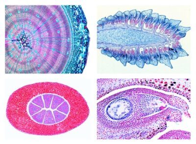 Gimnosperme, set di dettagli, 15 vetrini per microscopio