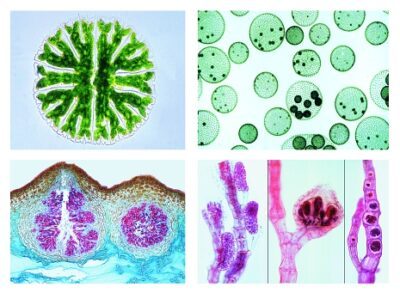 Crittogame. Set dettagliato, Alghe, 30 vetrini per microscopio