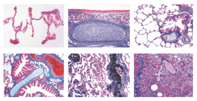 Serie Coronavirus Covid-19, 6 vetrini microscopici in scatola