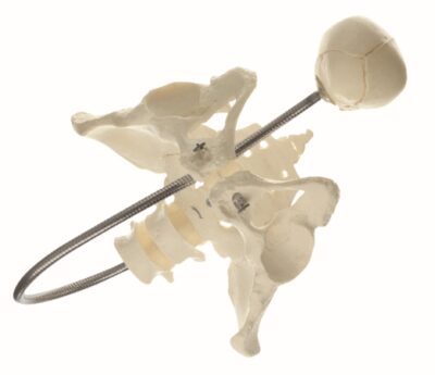 Fantasma ostetrico
