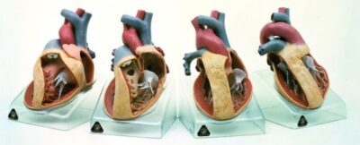 Serie di modelli che rappresentano organi organici congeniti