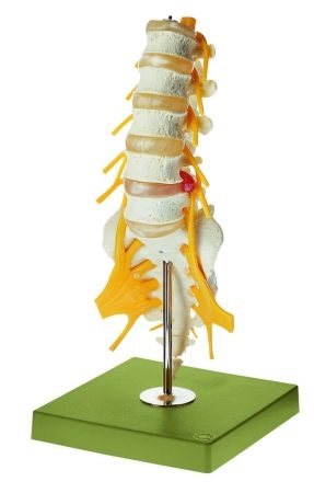Colonna vertebrale lombare