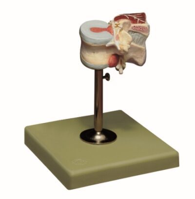 Prima vertebra lombare con dischi intervertebrali e muscoli dorsali