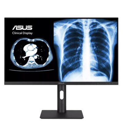 Medical Monitor – 3.6MP (2560 x 1440) AGLR