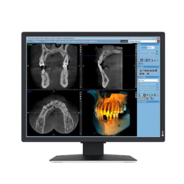 Radiforce MX217-SB