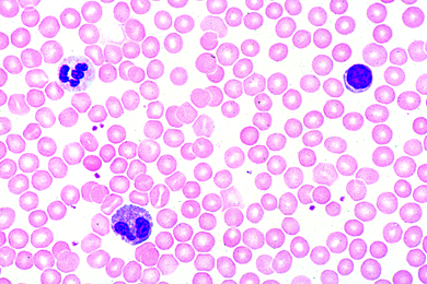 Human blood smear, msl