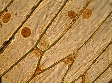 The cell wall of the onion