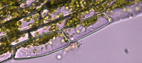 Vacuole