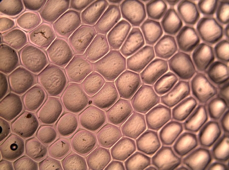 Upper epidermis of a deciduous leaf