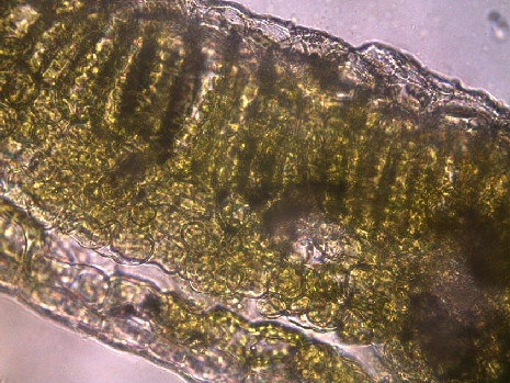 Cross-section of a deciduous leaf