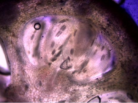 Cross-section of a plant ovary
