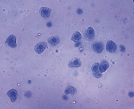 Liver cells (hepatocytes)