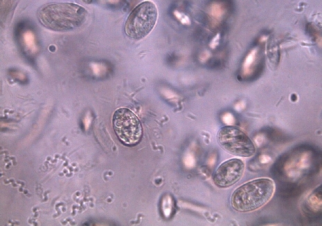 Ciliates in a hay infusion