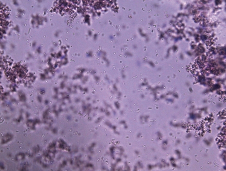Bacteria