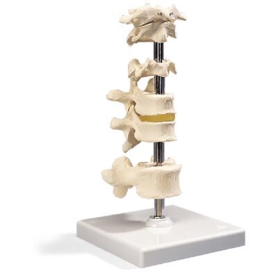 6 vertebre montate