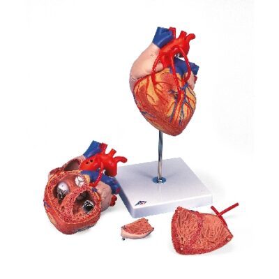 Cuore con bypass, ingrandito 2 volte, in 4 parti