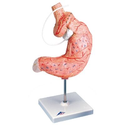 Modello di bendaggio gastrico