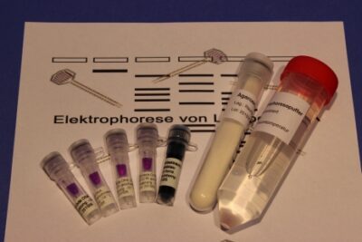 Kit: Elettroforesi su gel di agarosio del DNA Lambda